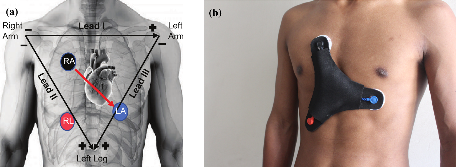 Low-Cost Wearable ECG Diagram